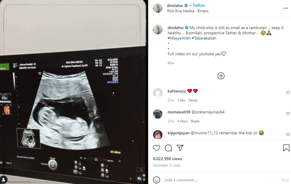 Dinda Hauw announced her pregnancy
