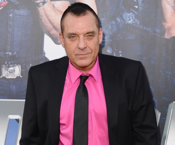 Tom Sizemore is suffering from brain aneurysm